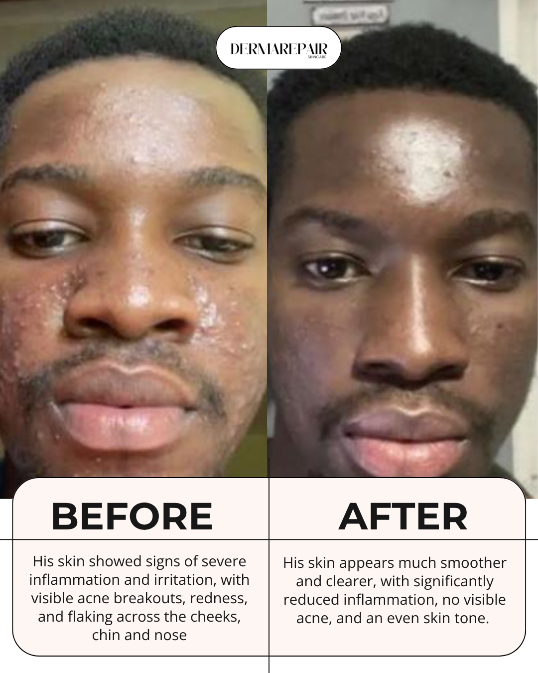 DermaRepair Facial Set – Brighten, Clear & Restore